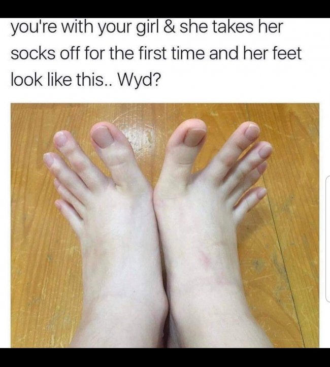 crazy toes.jpg
